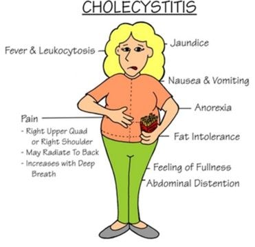 cholecystitis symptoms