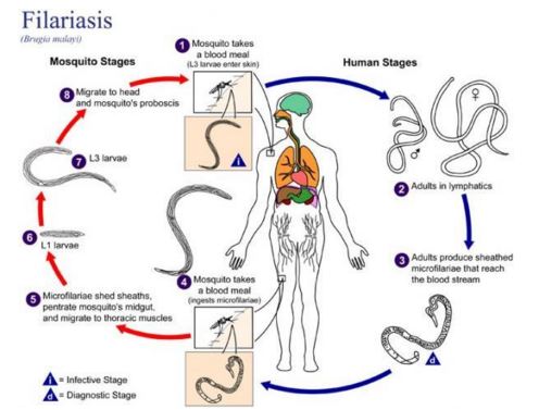 filariasis pathogenesis causes